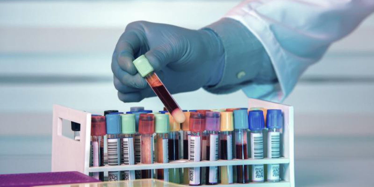 Global Biobanking Market Share, Growth and Revenue Report 2024-2032