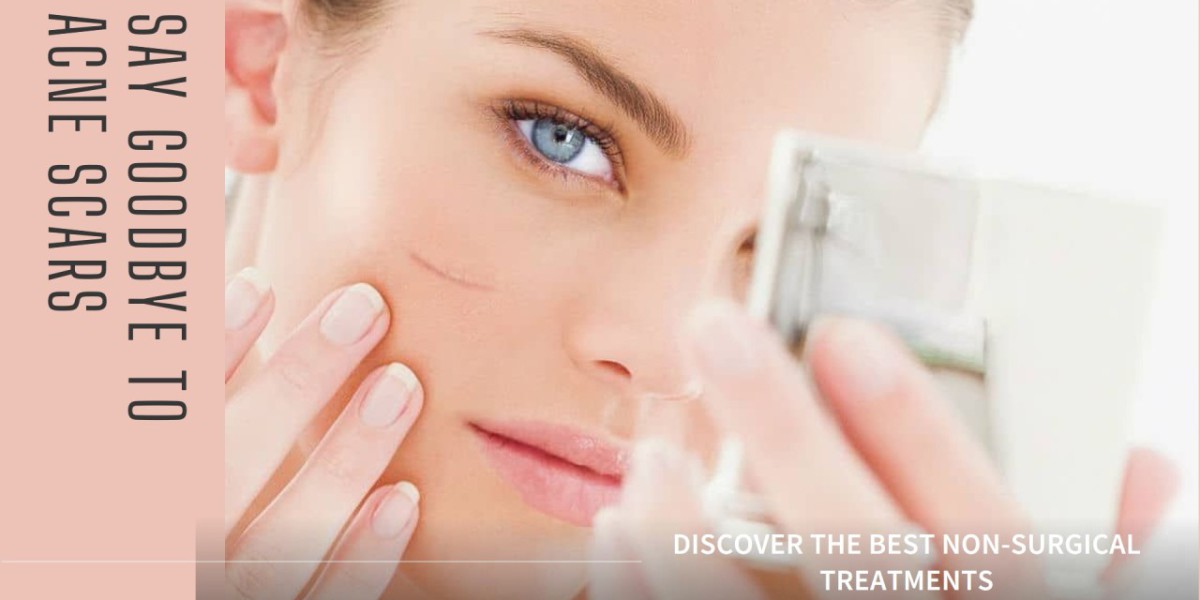 Laser vs Chemical Peel: Which is Right for Your Acne Scars?