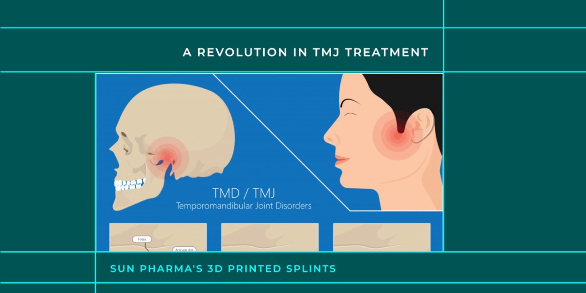 Teva's Neuromodulation Devices: A Non-Surgical Solution