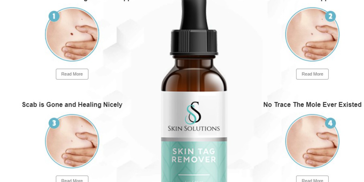 Skin Solutions Skin Tag Remover Reviews{⚠️NEW BEWARE!❌} Is Official Website Claims Fake Or Real!