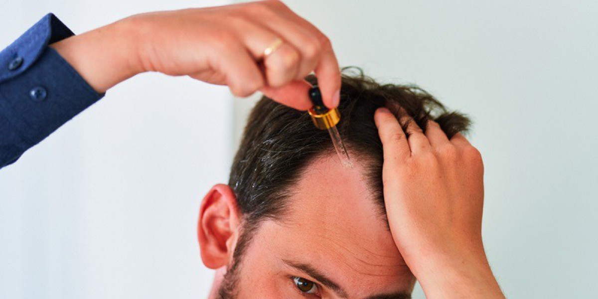 Best Hair Serum for Men: Boost Growth and Strength Naturally